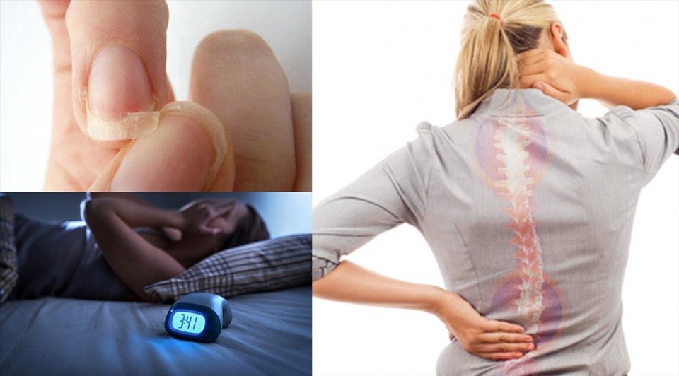 dấu hiệu thiếu canxi ở người lớn tuổi